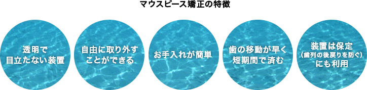 マウスピース矯正の特徴